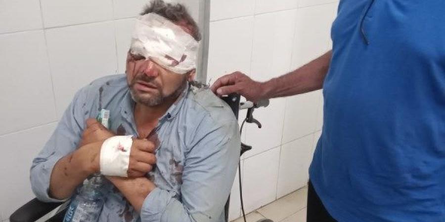 إصابة معلمين في حادث سير خلال توجههما لأعمال امتحانات الشهادة الإعدادية